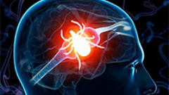 Uchroń się przed kleszczowym zapaleniem mózgu!