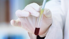 Punkt pobrań krwi w Młynarach.